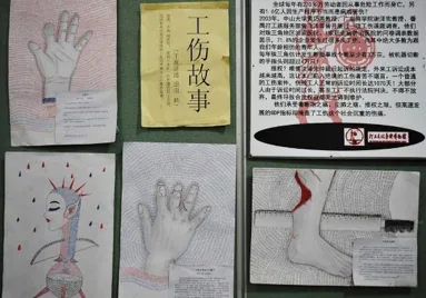展板题为“工伤故事”，两侧配有描绘伤手的插画（其中一幅带红色伤痕），右下角另有一张脚部受伤的照片，具体说明文字较小模糊难辨。